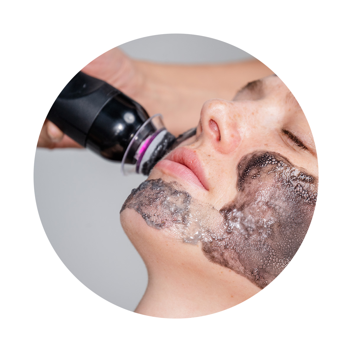 Oxfoliation™