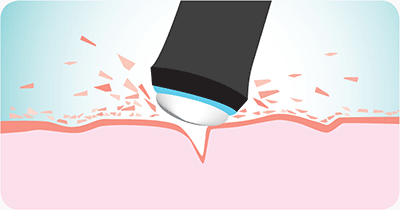 1. EXFOLIATE