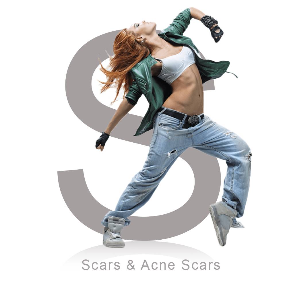 Scars & Acne Scars 
