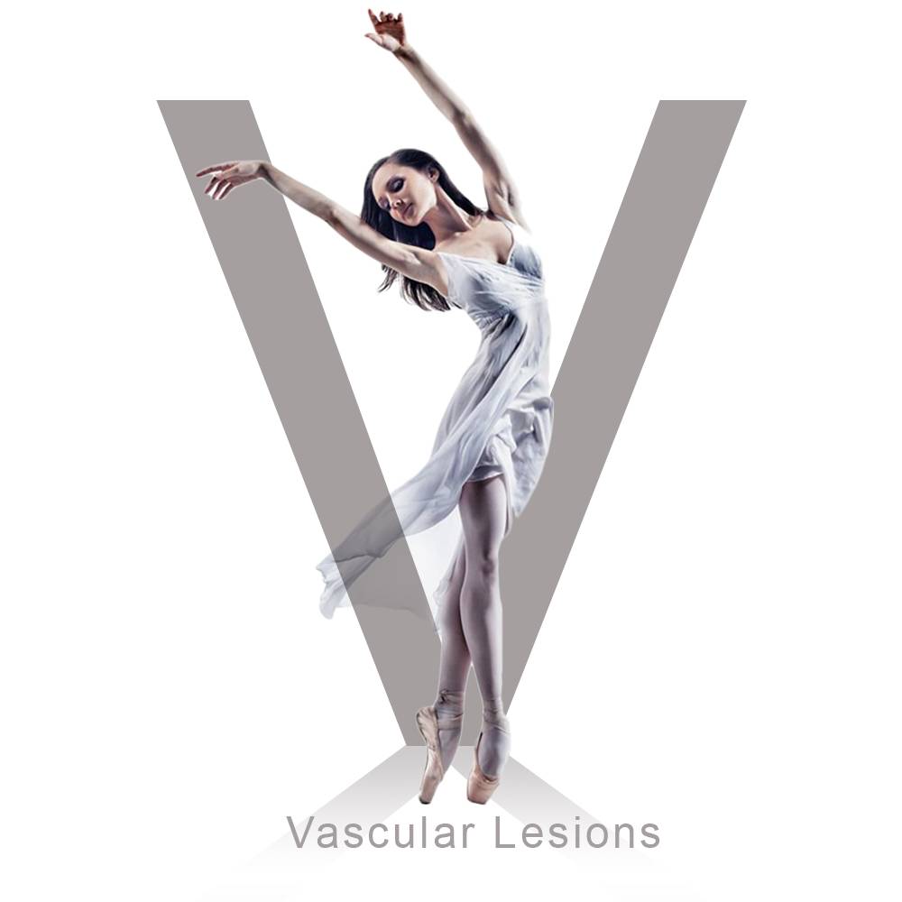 Vascular Lesions